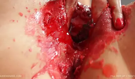 شکم گالری انال شهوانی